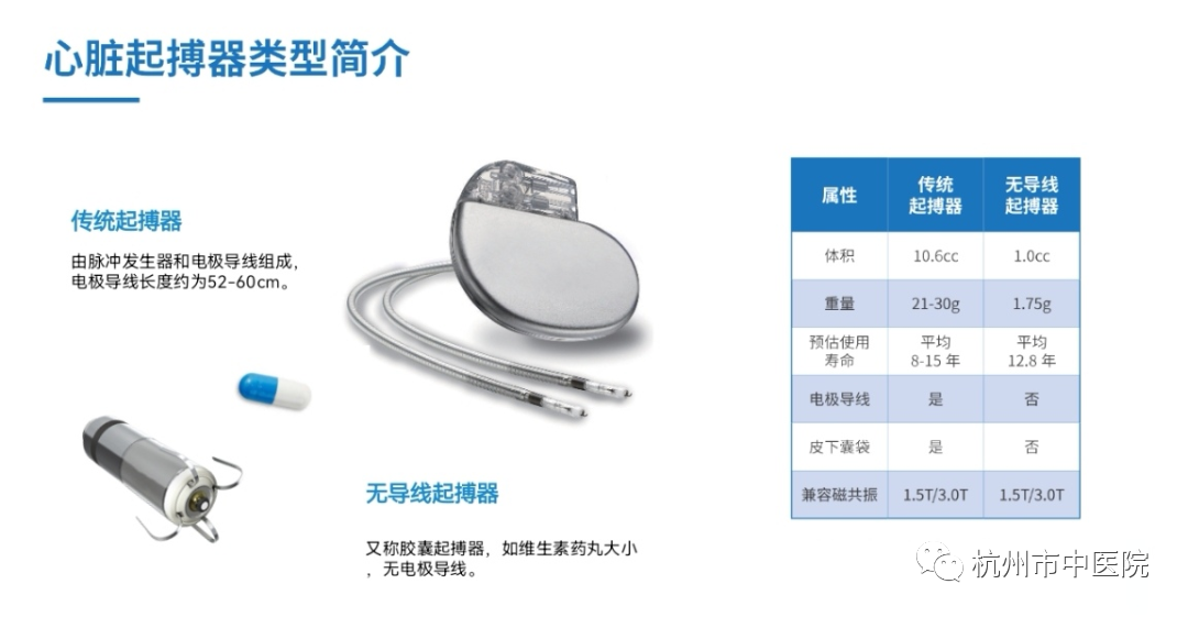 三腔起搏器價格及壽命解析